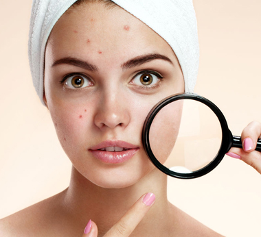 acne facial treatment in Sunnyvale, TX