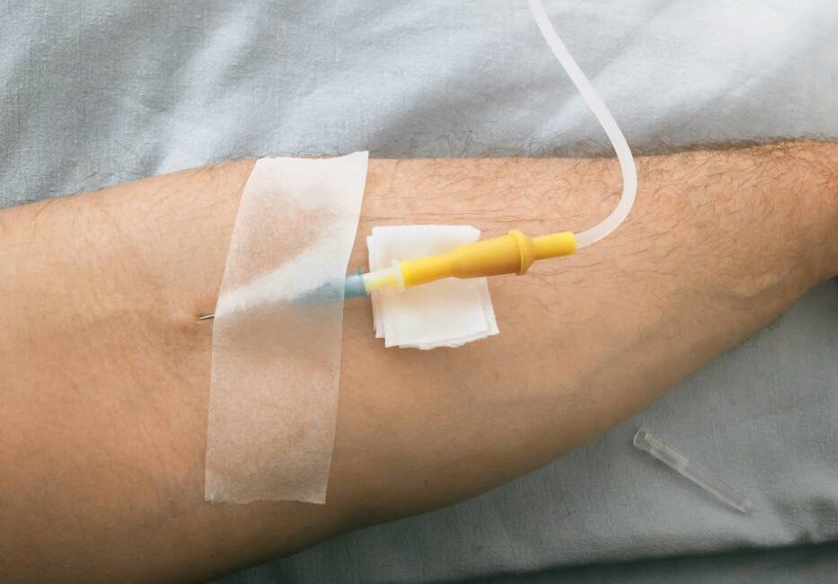 IV Fluid Therapy: What It Is and How It Benefits You