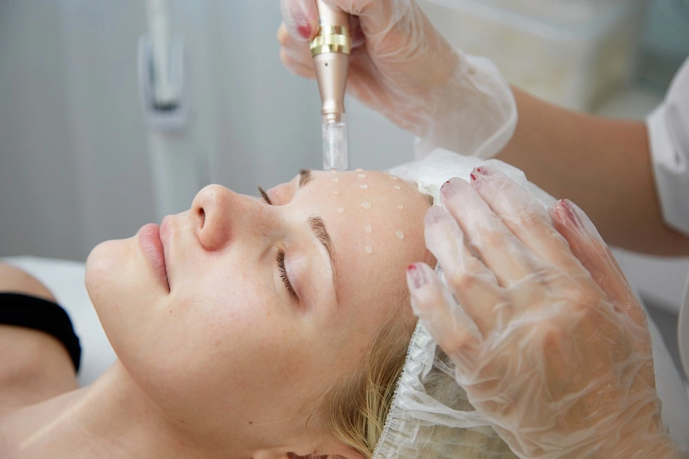 SkinStylus Microneedling Treatment in Sunnyvale, TX